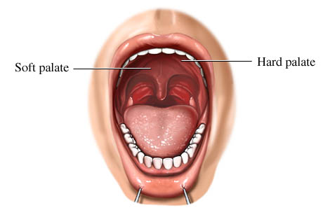 Soft_palate